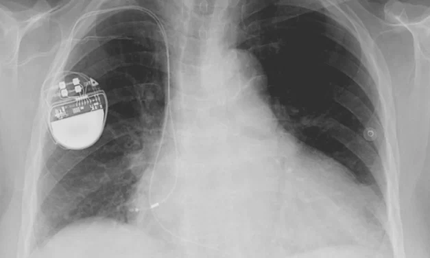 Smarthpone e possibile rischio per pacemaker e defibrillatori, al via uno studio Iss